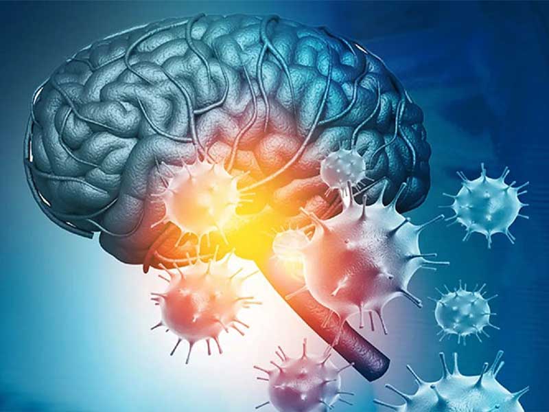 درگیر شدن مغز به کووید-19 از درگیر شدن ریه خطرناک‌تر است