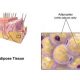 نقش چربی زیر پوست در محافظت از بدن در برابر عفونت‌های باکتریایی
